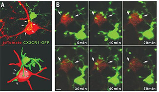 somatic microglia-neuron junction