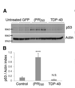p53 is a central regulator driving neurodegeneration caused by C9orf72 poly(PR) img3