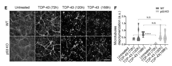 p53 is a central regulator driving neurodegeneration caused by C9orf72 poly(PR) img5