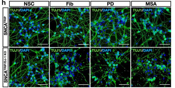 PD／MSA由来増幅 α-Syn の ドパミン神経細胞毒性についてと、DJ-1 欠失の影響について検証