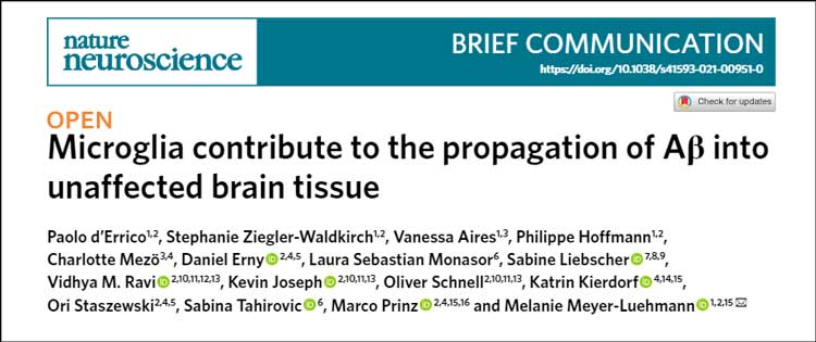nat-neurosci-2021-microglia-ab-propagation-title