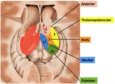 thalamic-incidentaloma-1-2