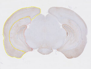 Qupath-area-threshold-3