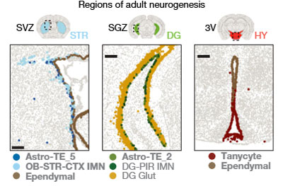 Nature-2025-BrainAgeing-3