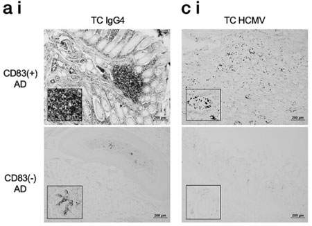 AlzDemenz-2025-CMV-CD83microglia-AD-1