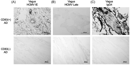 AlzDemenz-2025-CMV-CD83microglia-AD-3